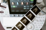 Echo-Son - Nowoczesne aparaty USG dla zaawansowanej diagnostyki medycznej